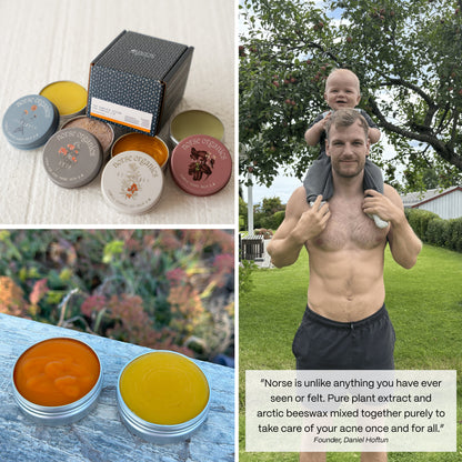 Pimple Stopper Night Balm