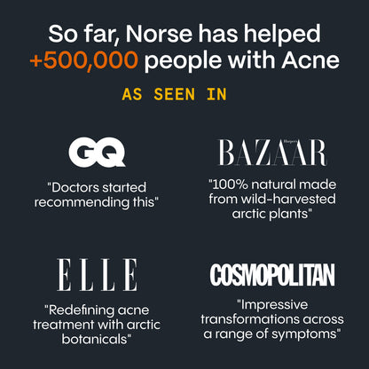 The Complete Acne Killer System 2.0